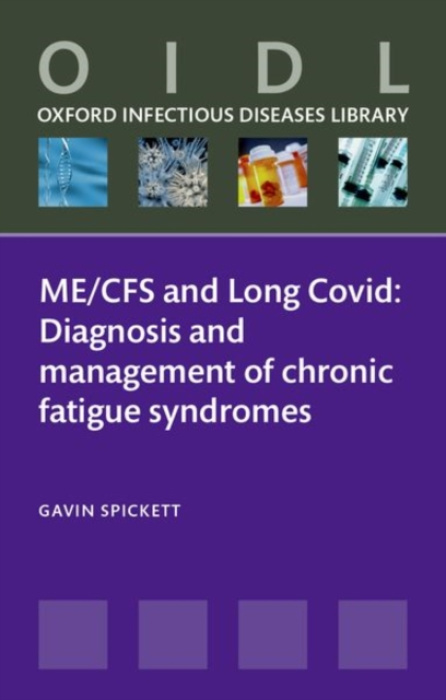 Oxford University Press ME/CFS and Long Covid - Spickett, Gavin (Retired consultant in Immunology, Allergy, and General Medicine, Retired consultant in Immunology, Allergy, and General Medicine, Royal Victoria Infirmary)