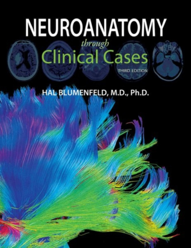 Neuroanatomy through Clinical Cases - Hal Blumenfeld,Neuroanatomy through Clinical Cases - Hal Blumenfeld - kniha z kategorie Neurológia